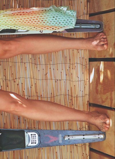 Рамона Бернхард